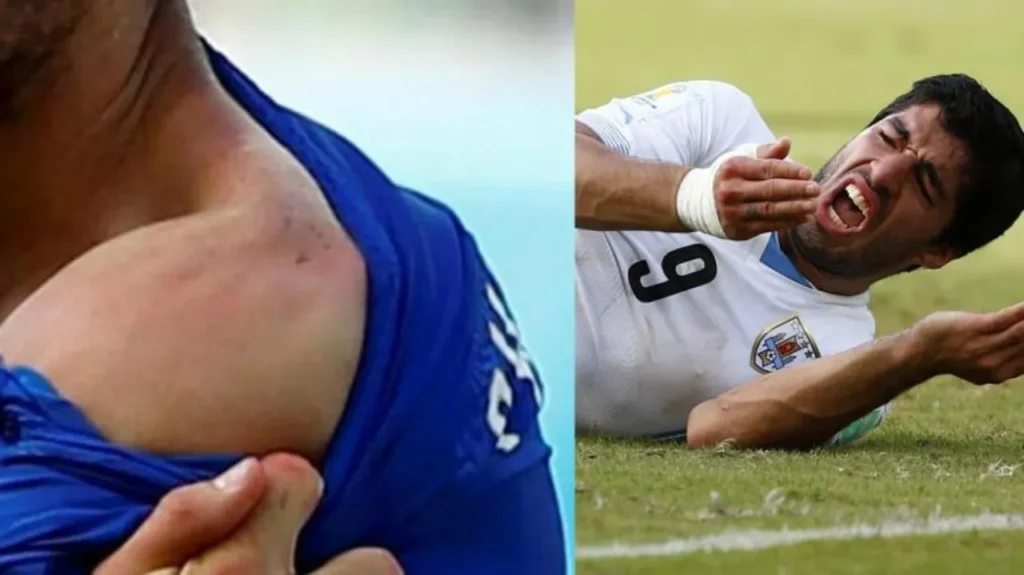 Hành vi cắn người cau Luis Suarez đã khiến cầu thủ này bị treo giò 4 tháng. 